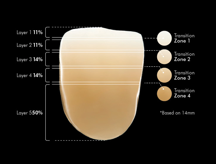 Vatech Perfit ZR™ STML