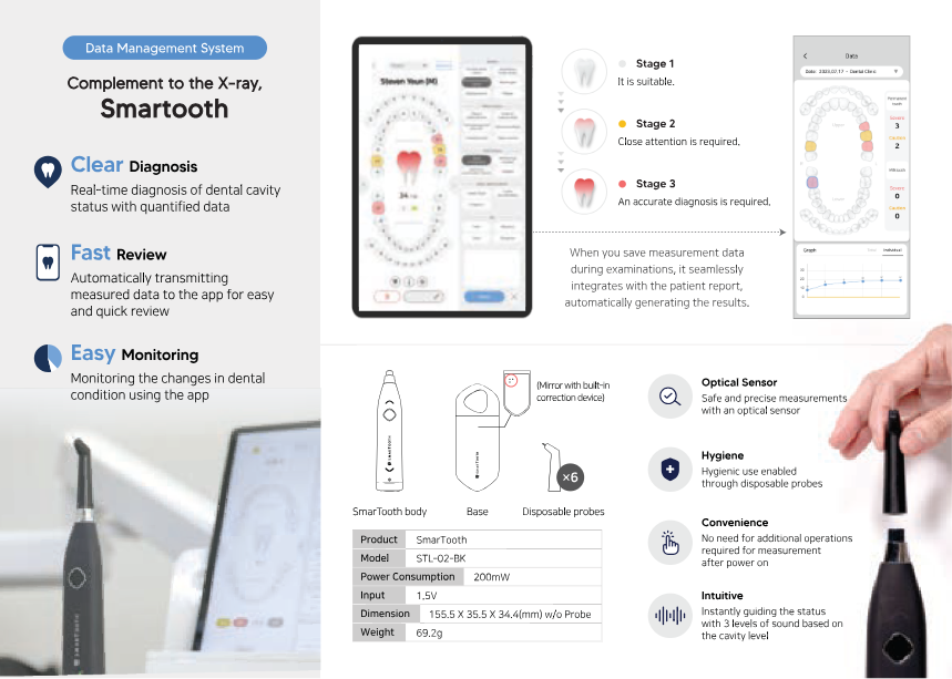 Smart Tooth